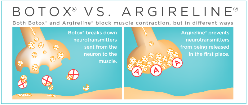 BOTOX-VS-ARGIRELINE